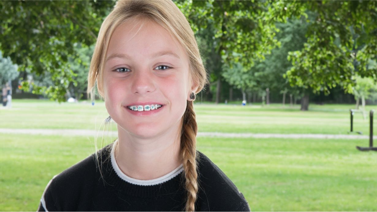 Braces kids smile