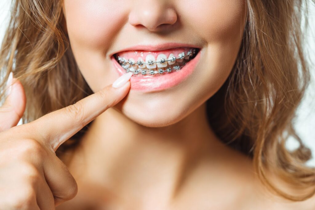 close-up-portrait-young-cheerful-readhead-woman-orthodontist
